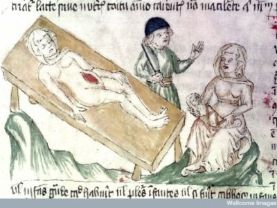 Taglio cesareo o parto&nbsp;cesareo?